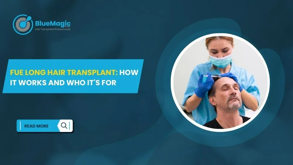 BlueMagic Clinic banner showcasing FUE long hair transplant procedure, featuring a medical professional performing treatment and text explaining its benefits.