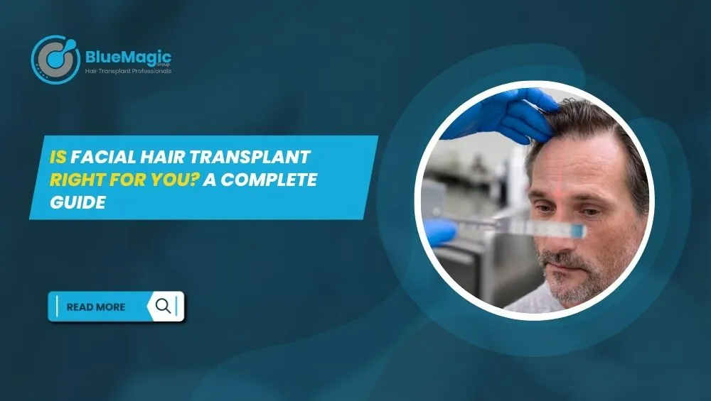 BlueMagic Clinic banner promoting facial hair transplant services with the text 'Is Facial Hair Transplant Right for You? A Complete Guide' and a medical professional performing a procedure.