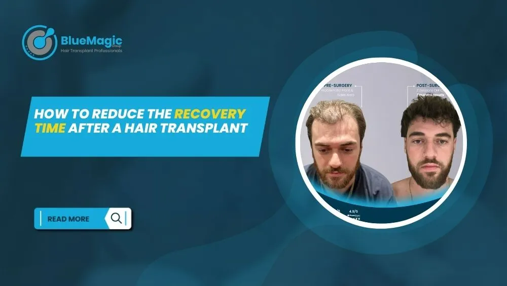 How to Reduce the Recovery Time After a Hair Transplant
