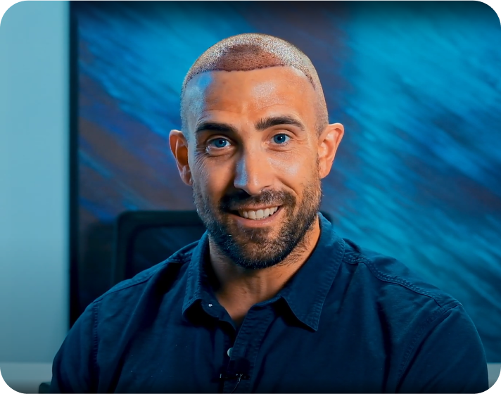 Patient testimonial featured on Bloomberg, highlighting their positive experience with advanced hair restoration treatments provided by BlueMagic Clinic.
