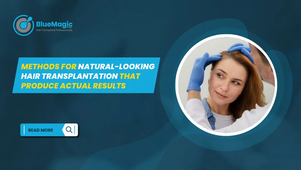 natural hair transplant