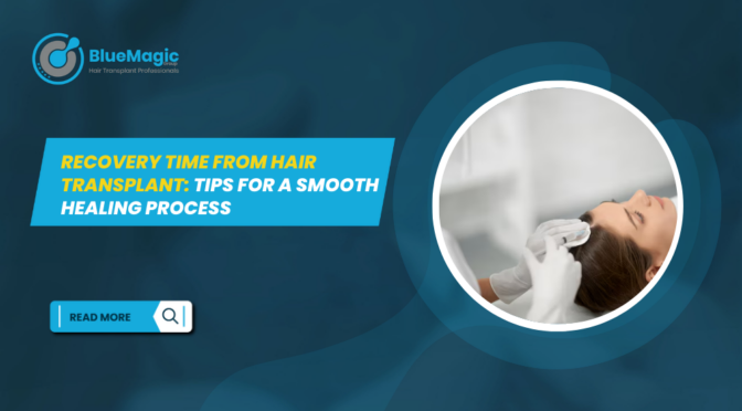 recovery time from hair transplant