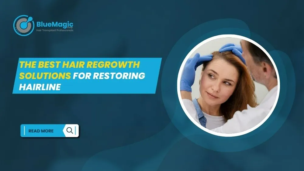 restoration hairline