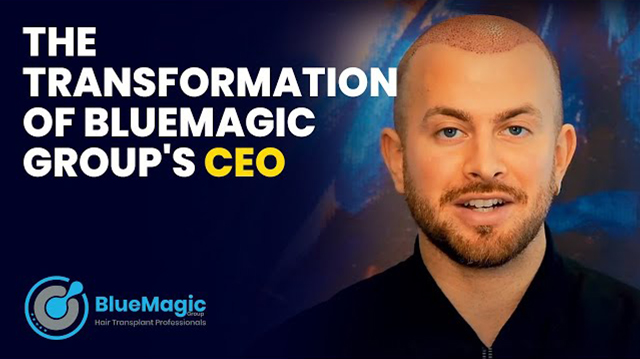 Video thumbnail showcasing a detailed explanation of the hair transplantation process at BlueMagic Group, including preparation and recovery stages.