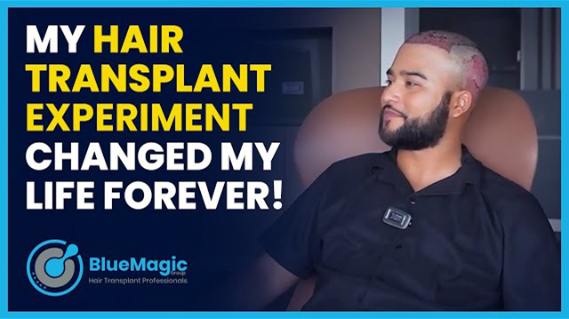 Video thumbnail featuring a detailed explanation of the hair transplantation process at BlueMagic Group, including preparation and recovery stages, with a focus on patient care and satisfaction.