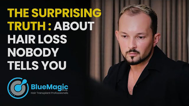 Video thumbnail highlighting the expertise of BlueMagic Group's medical team in performing advanced hair transplantation procedures, emphasizing precision and care during the surgical process