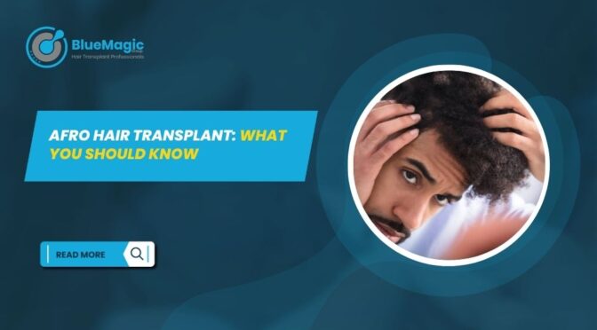 Afro Hair Transplant