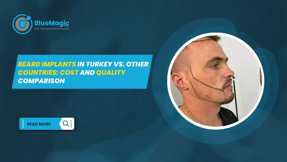 beard transplant turkey