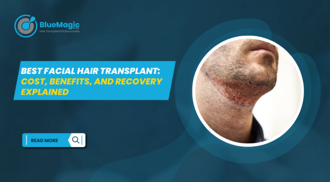 best facial hair transplant