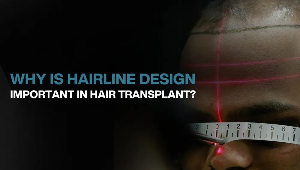 Copy of Hair transplant for Women 1