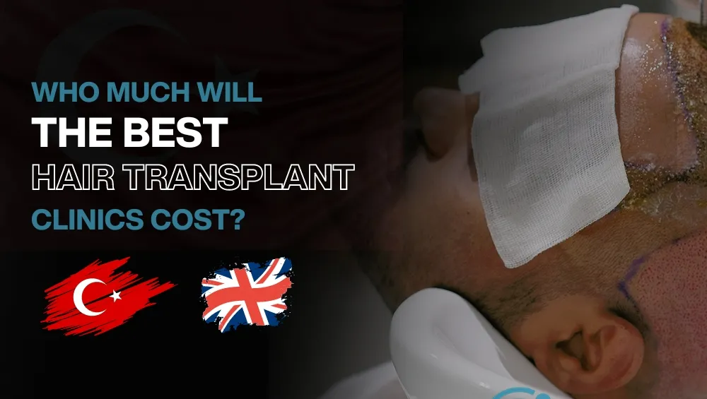 Copy of Hair transplant for Women 14