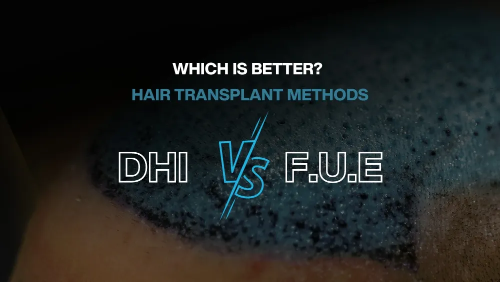 Copy of Hair transplant for Women 15