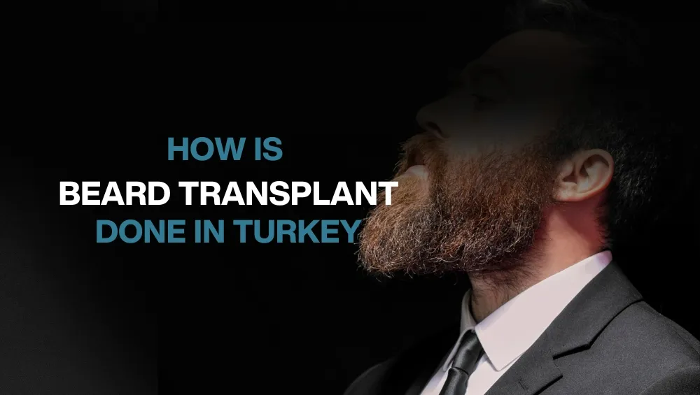 Copy of Hair transplant for Women 27