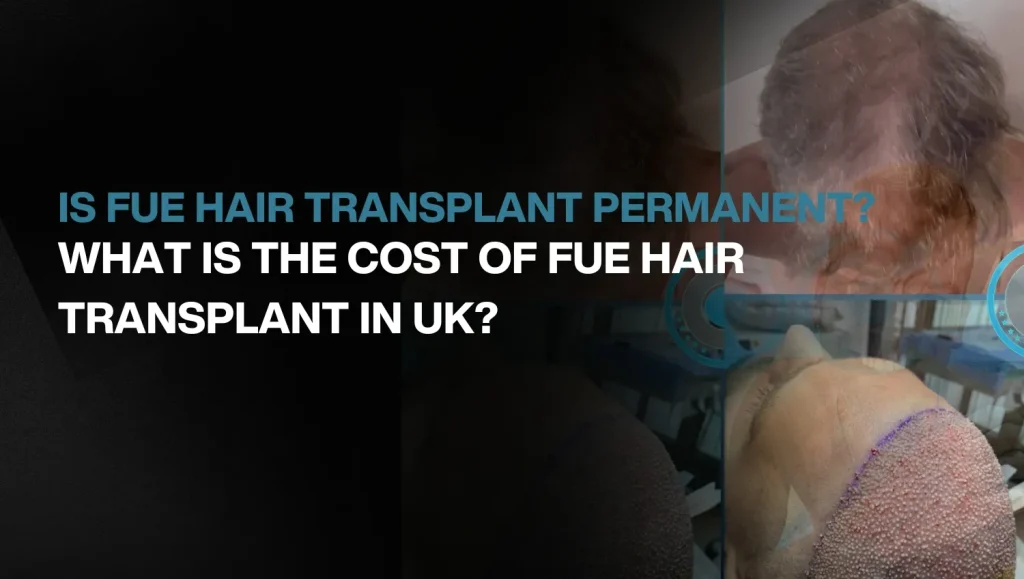 Copy of Hair transplant for Women 33