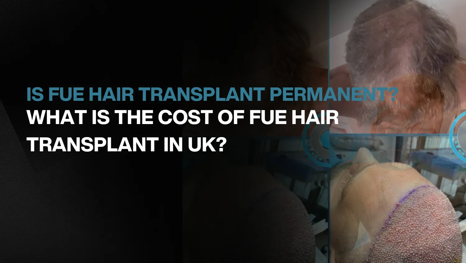 Copy of Hair transplant for Women 33