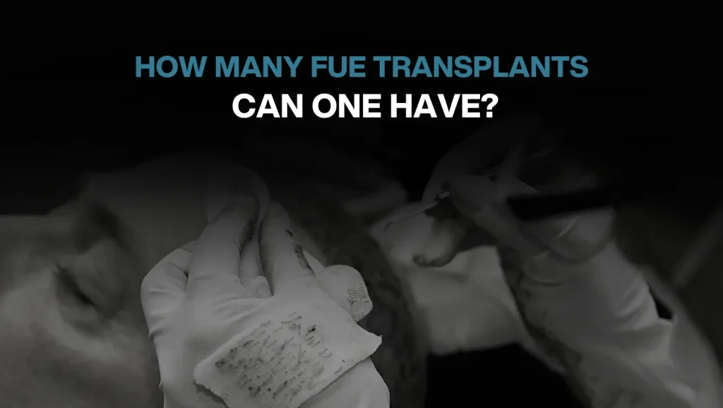 Copy of Hair transplant for Women 36