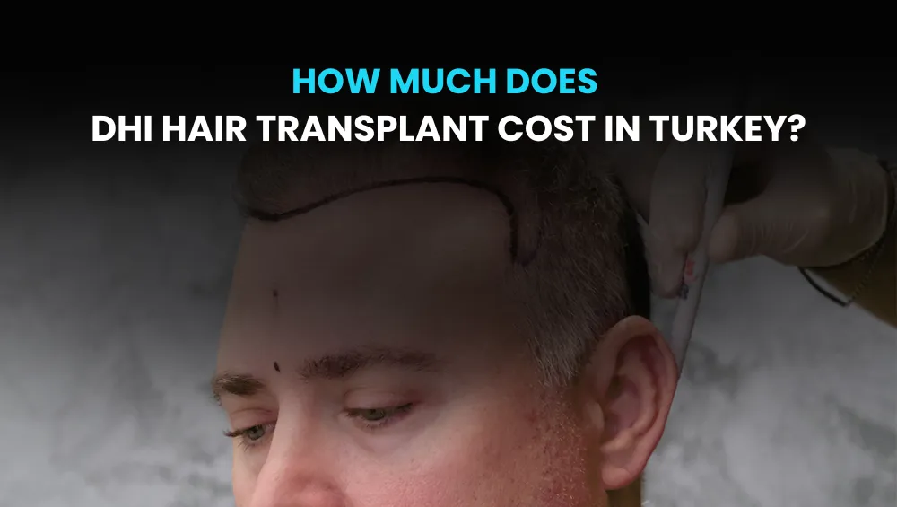 DHI Hair Transplant Cost in Turkey