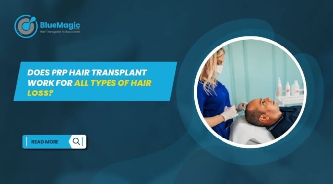 PRP Hair Transplant