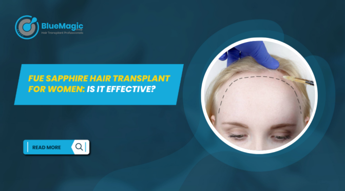 FUE Sapphire Hair Transplant for Women