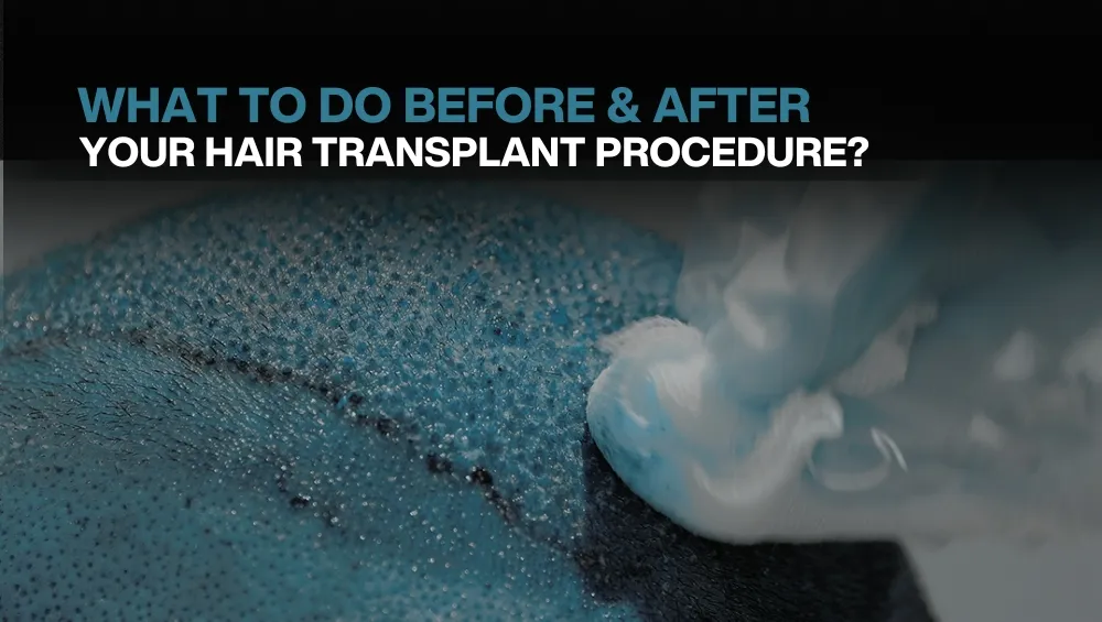 What to do before and after hair transplant