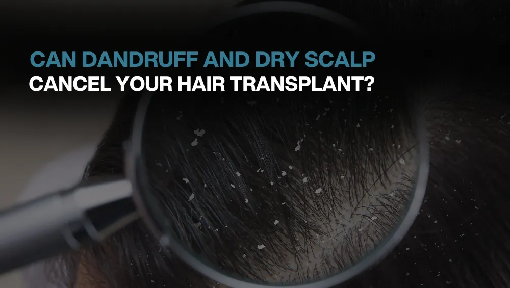 Hair transplant in Turkey
