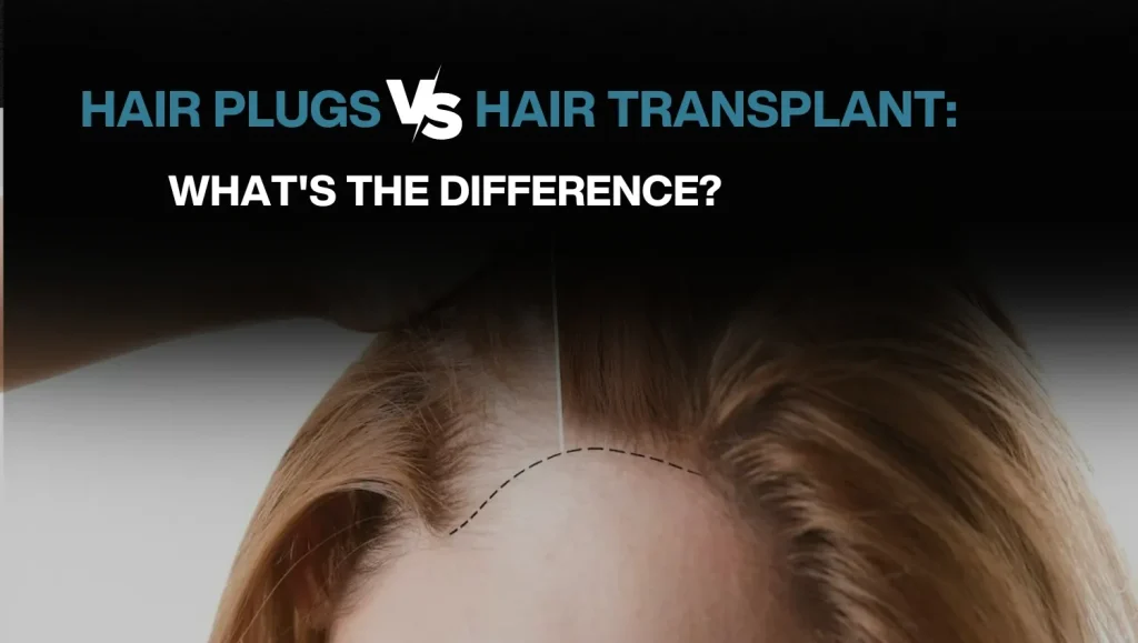 Hair transplant for Women 4