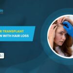 How FUE Hair Transplant Helps Women with Hair Loss