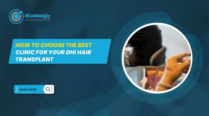 DHI Hair Transplant