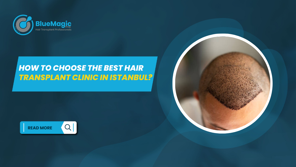 Hair Transplant Clinic in Istanbul