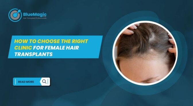 Female Hair Transplants