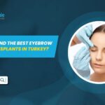 Eyebrow Hair Transplants