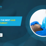 How to Find the Best Hair Surgeon in Turkey