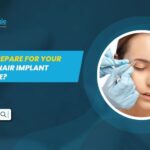 Eyebrow Hair Implant