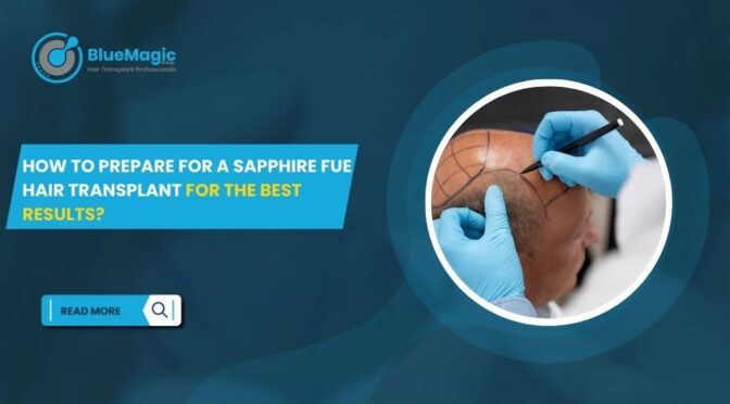 How to Prepare for a Sapphire FUE Hair Transplant for the Best Results
