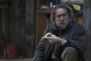 Nicolas Cage Hair Transplant (2)