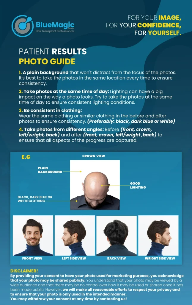 Step-by-step photo guide illustrating the process and benefits of advanced hair restoration techniques used by BlueMagic Group Ltd.