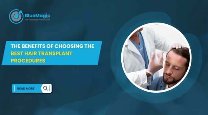 The Benefits of Choosing the Best Hair Transplant Procedures