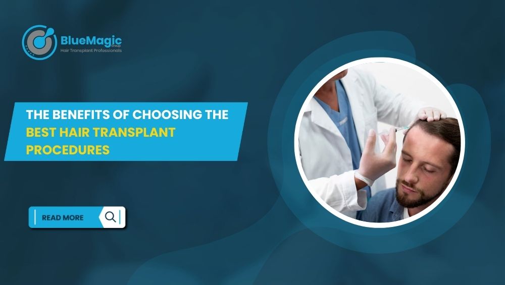The Benefits of Choosing the Best Hair Transplant Procedures