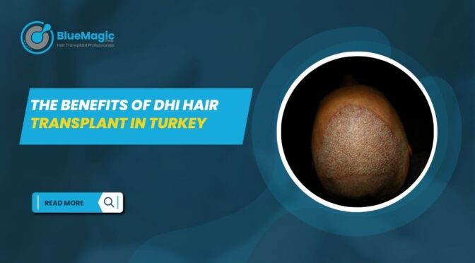 DHI Hair Transplant