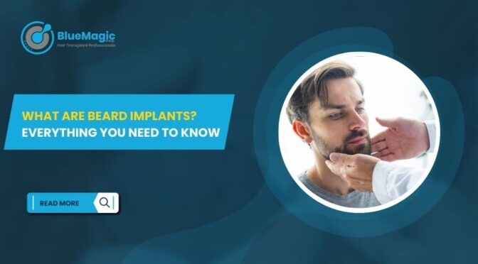 What Are Beard Implants Everything You Need to Know