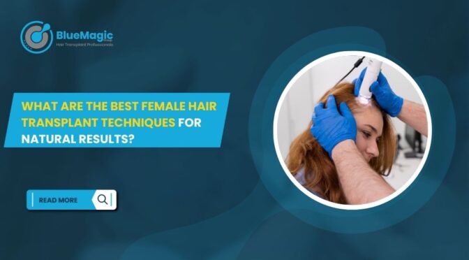 What Are the Best Female Hair Transplant Techniques for Natural Results