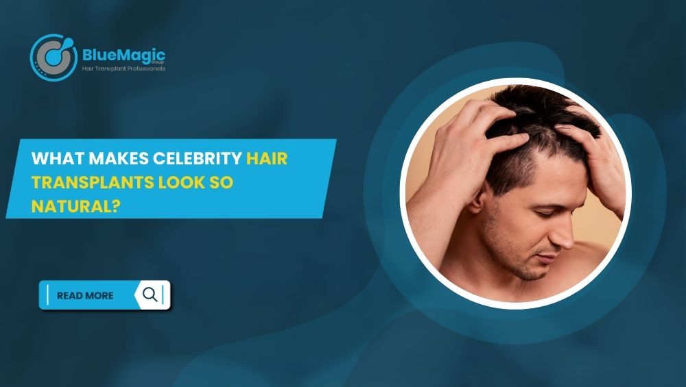What Makes Celebrity Hair Transplants Look So Natural