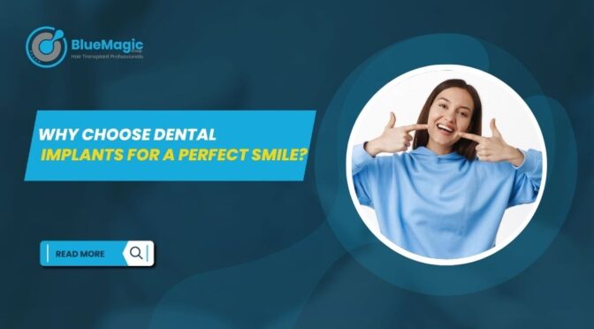 dental implants