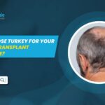 fue transplant turkey