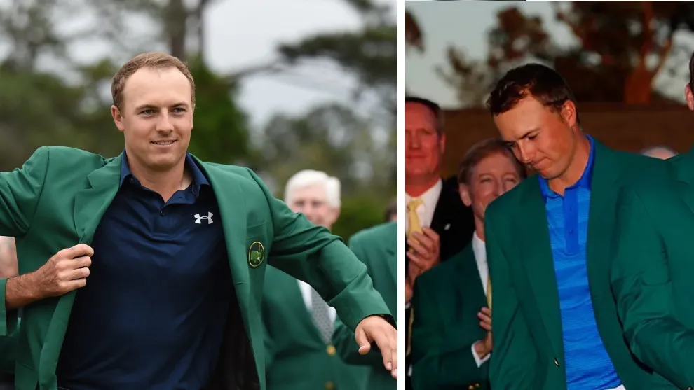 hair transplant of jordan spieth