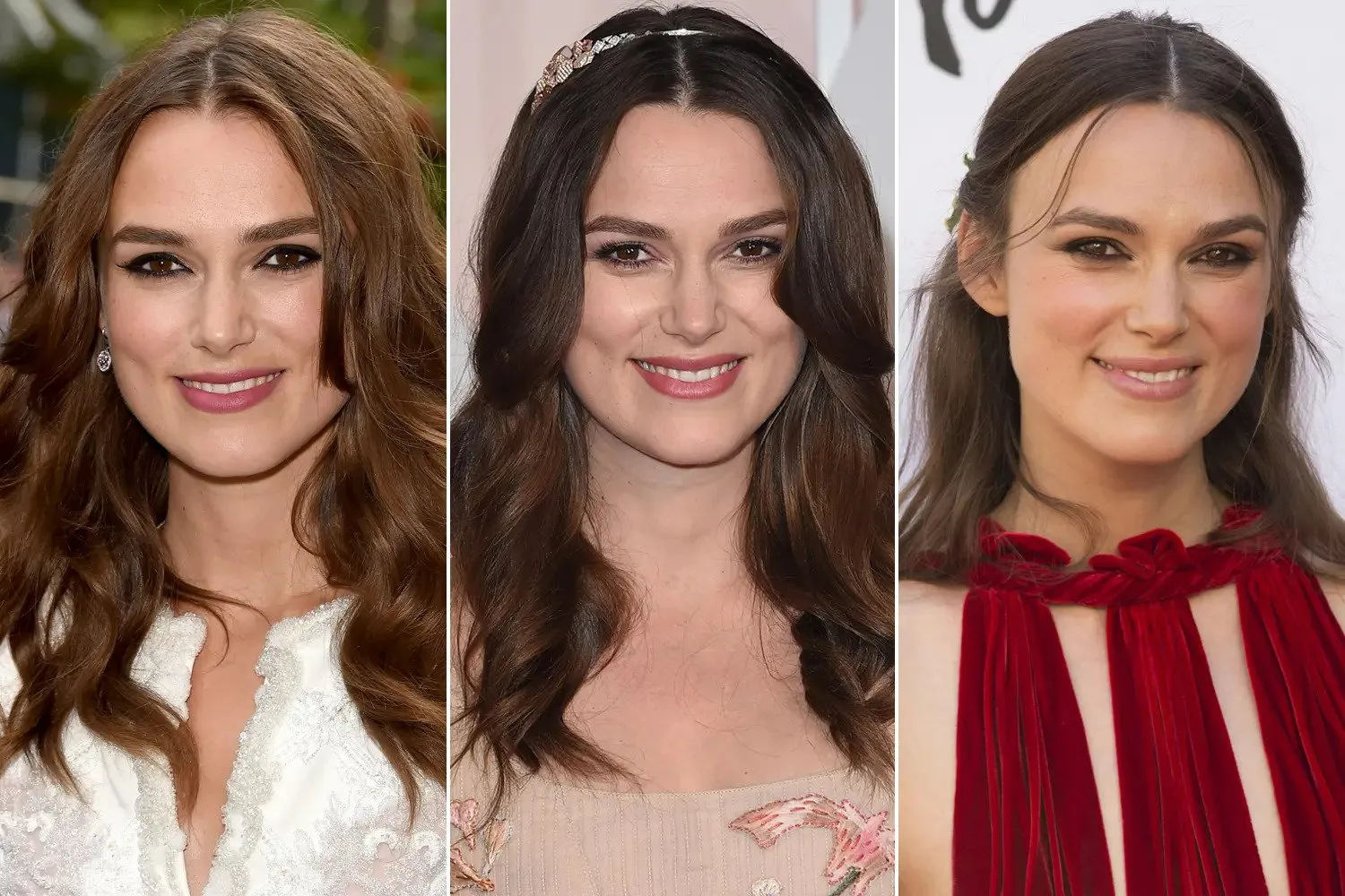 keira hair transplant