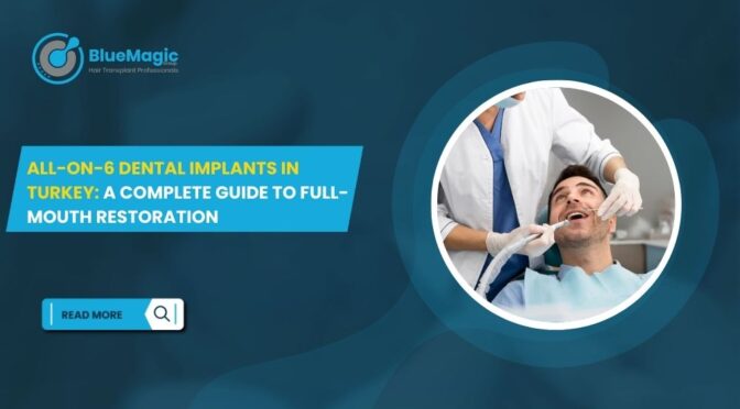 All-on-6 Dental Implants in Turkey: A Complete Guide to Full-Mouth Restoration
