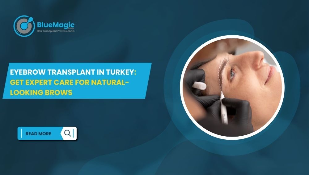 Eyebrow Transplant in Turkey Get Expert Care for Natural-Looking Brows