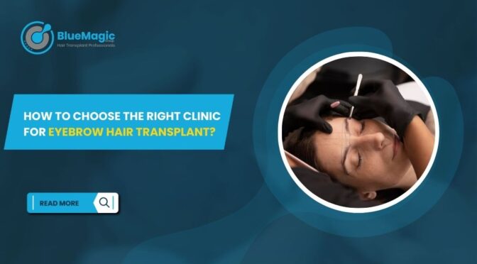 How to Choose the Right Clinic for Eyebrow Hair Transplant