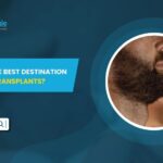 Is Turkey the Best Destination for Beard Transplants